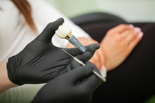 A close-up of a dental implant in the dentist’s hand during consultation.