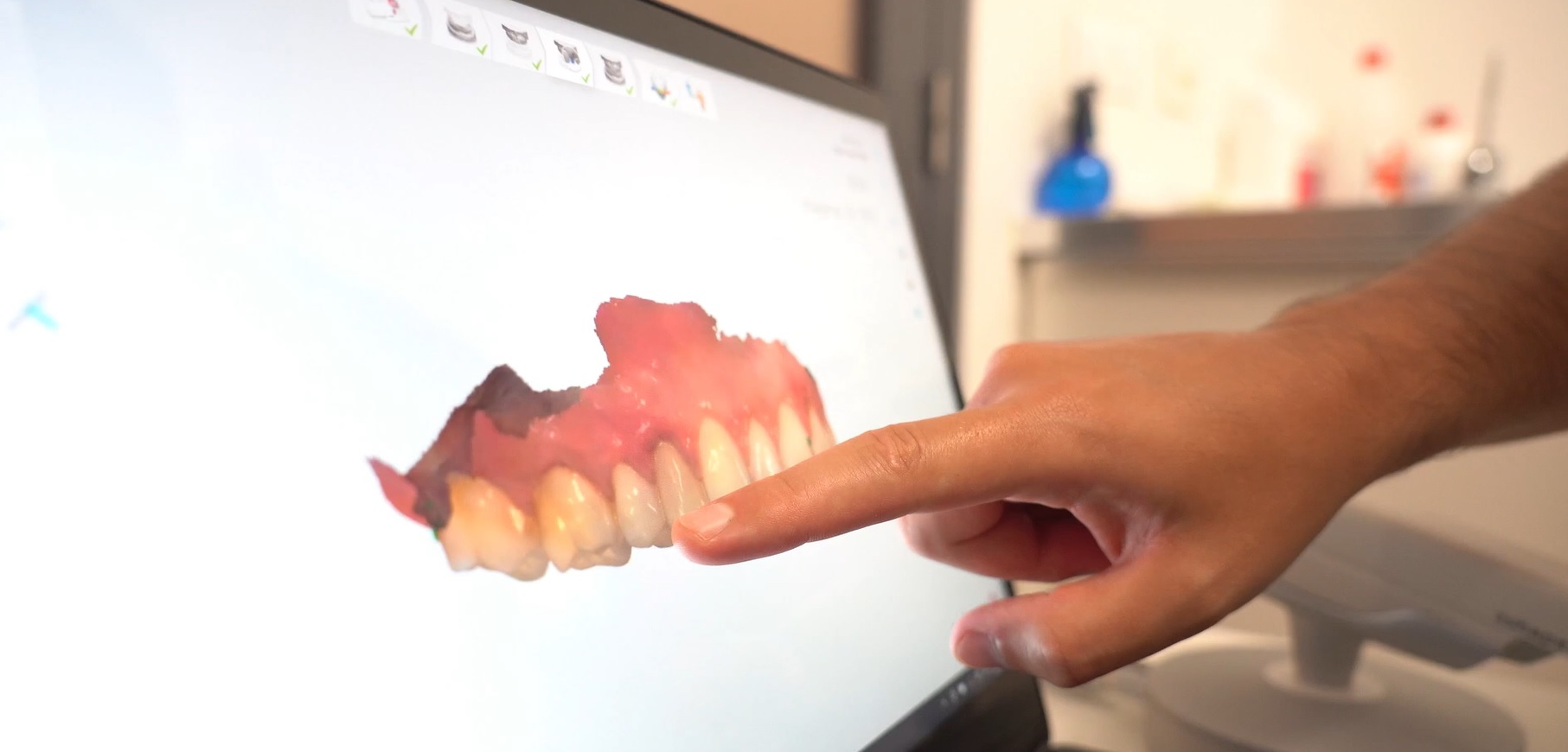 A man pointing at a teeth visual displayed on a monitor screen.