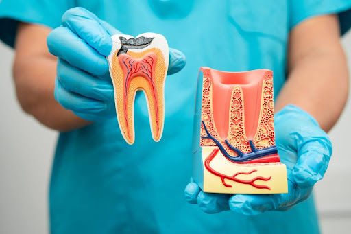 A dentist is showing a diagram of a root canal.