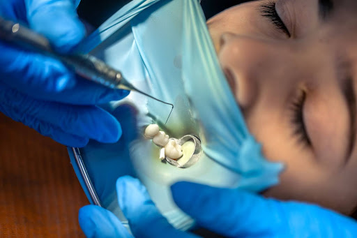 A dentist is working on a patient's teeth.